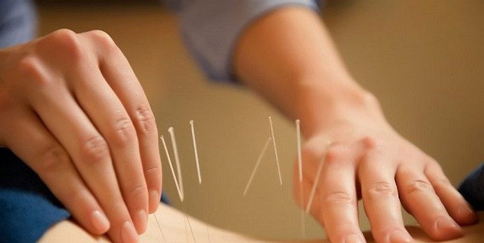 وضعیت شواهد طب سوزنی در واژینیسموس