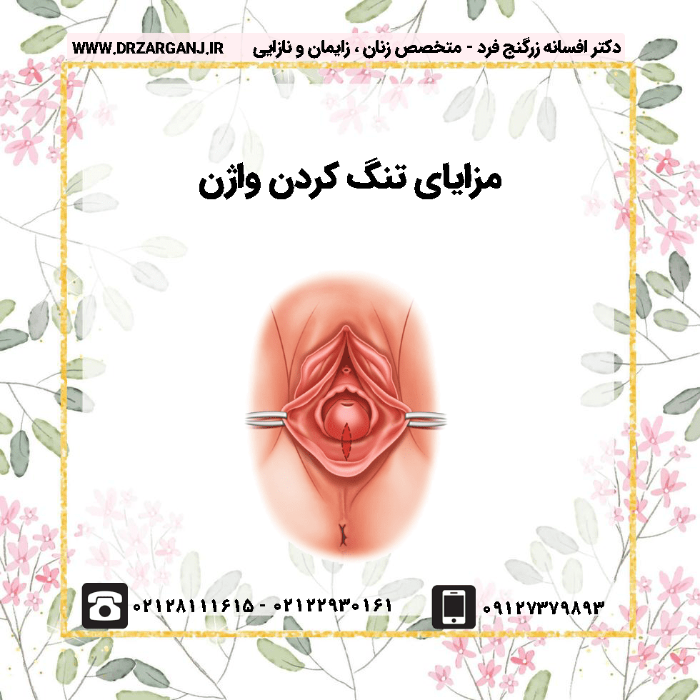 مزایای تنگ کردن واژن | لیست کامل مزایا از نگاه فوق تخصص زنان