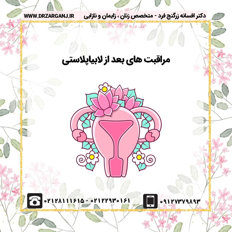 مراقبت های بعد از لابیاپلاستی