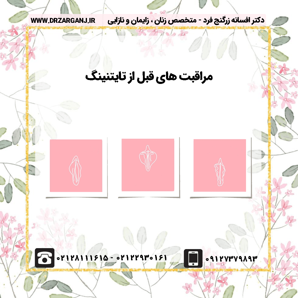 مراقبت های قبل از تایتنینگ