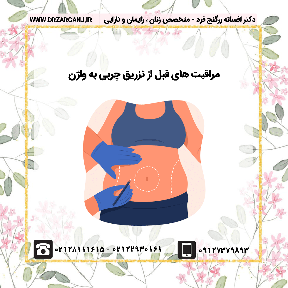مراقبت های قبل از تزریق چربی به واژن