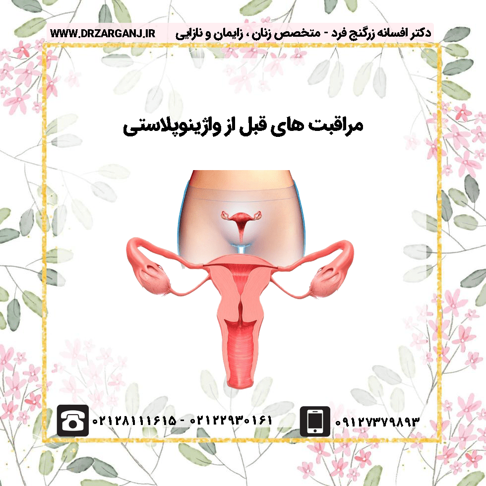 مراقبت های قبل از واژینوپلاستی