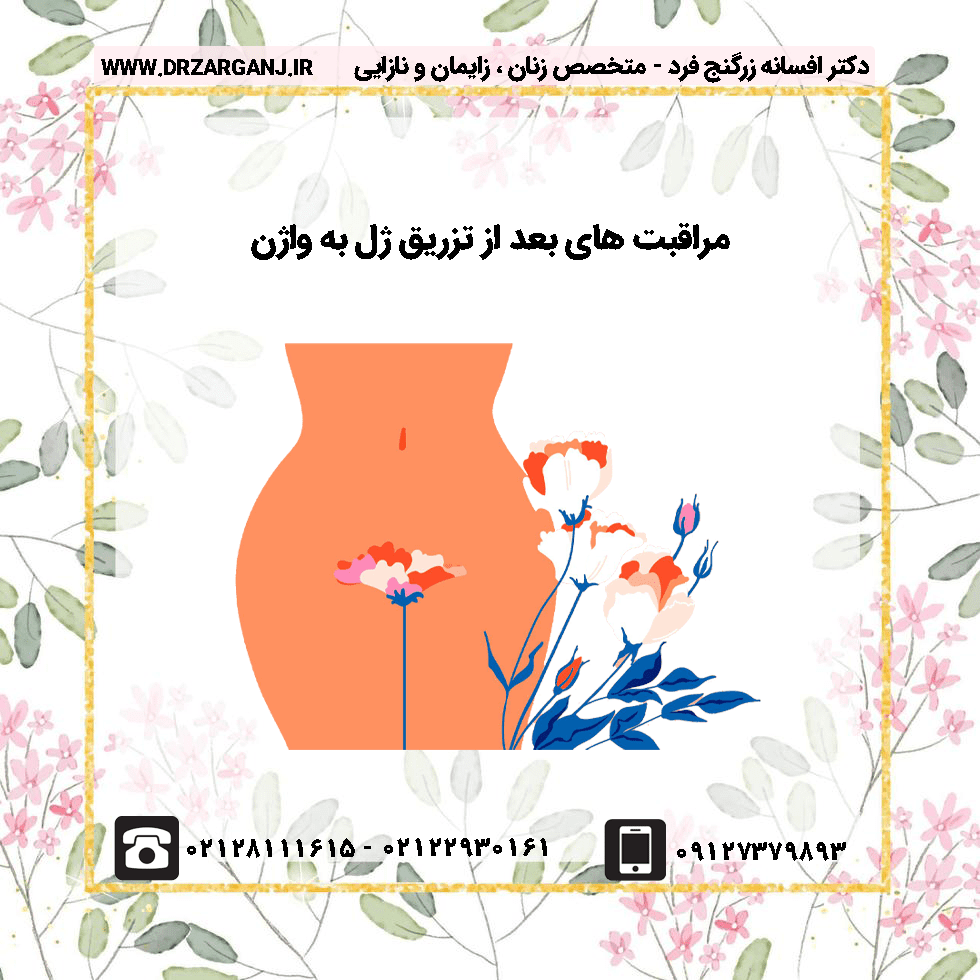 مراقبت های بعد از تزریق ژل به واژن